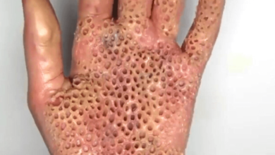 Hand:_Odq5adp-8a= Holes