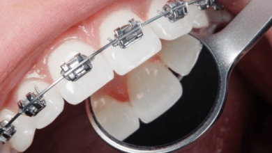 Orthodontics for Adults in Las Vegas Is on the Rise