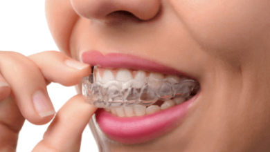 How the Invisalign Procedure Works with the Help of an Orthodontist in Surrey