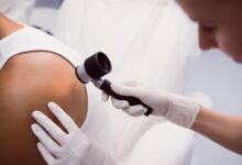 Top Tips To Find the Best Skin Cancer Clinic