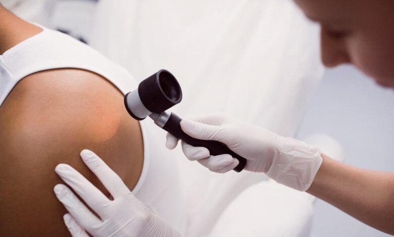 Top Tips To Find the Best Skin Cancer Clinic