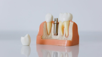 Advances in Implant Dentistry That Help Patients Recover Faster