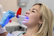 Frequent Whitening Attempts Are Damaging Enamel Without Lasting Results