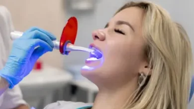 Frequent Whitening Attempts Are Damaging Enamel Without Lasting Results